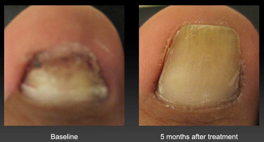before-after-nail-3-1.jpg