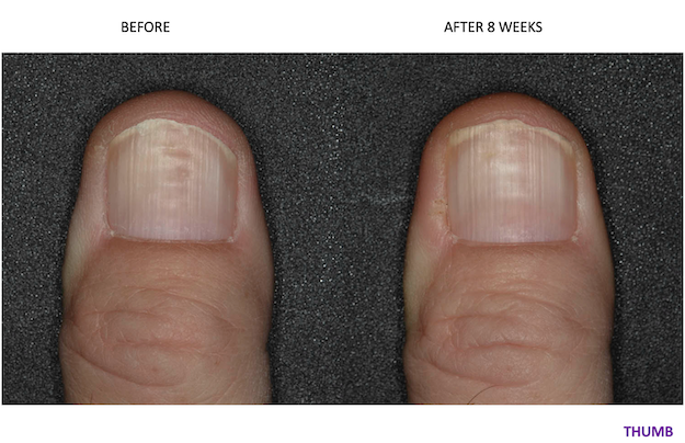 before-after.webp